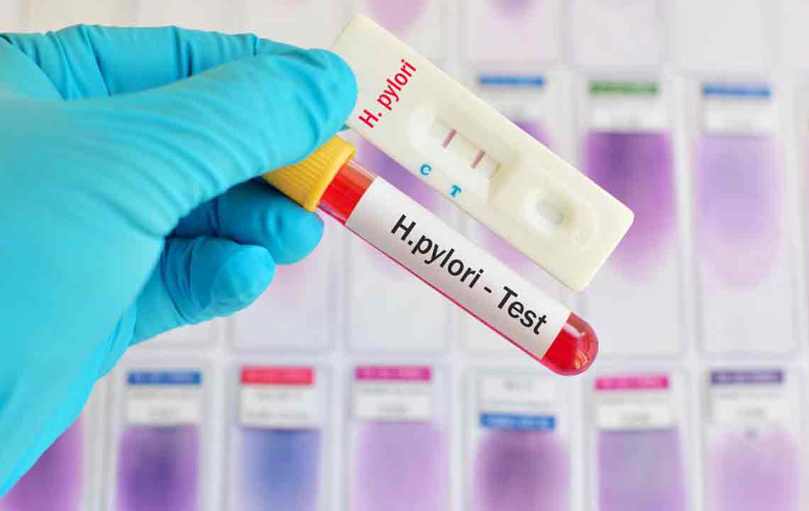 Comprehensive Guide to Treating Helicobacter pylori Infection