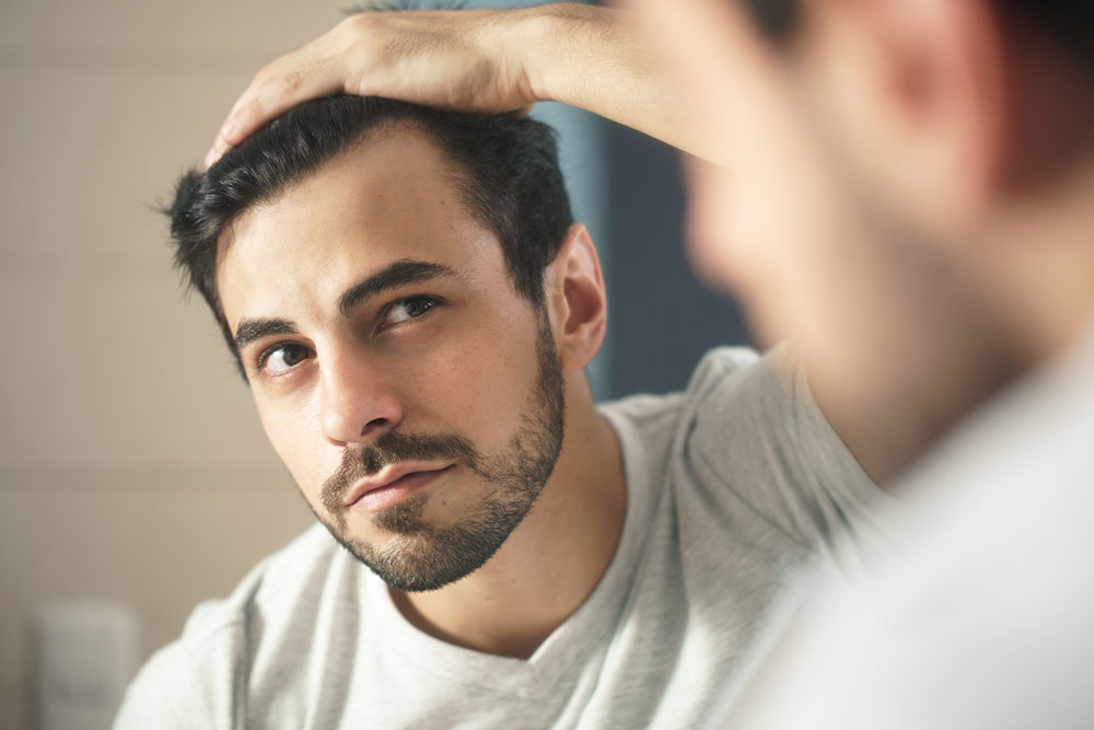 Comprehensive Natural Strategies to Effectively Manage Alopecia Areata
