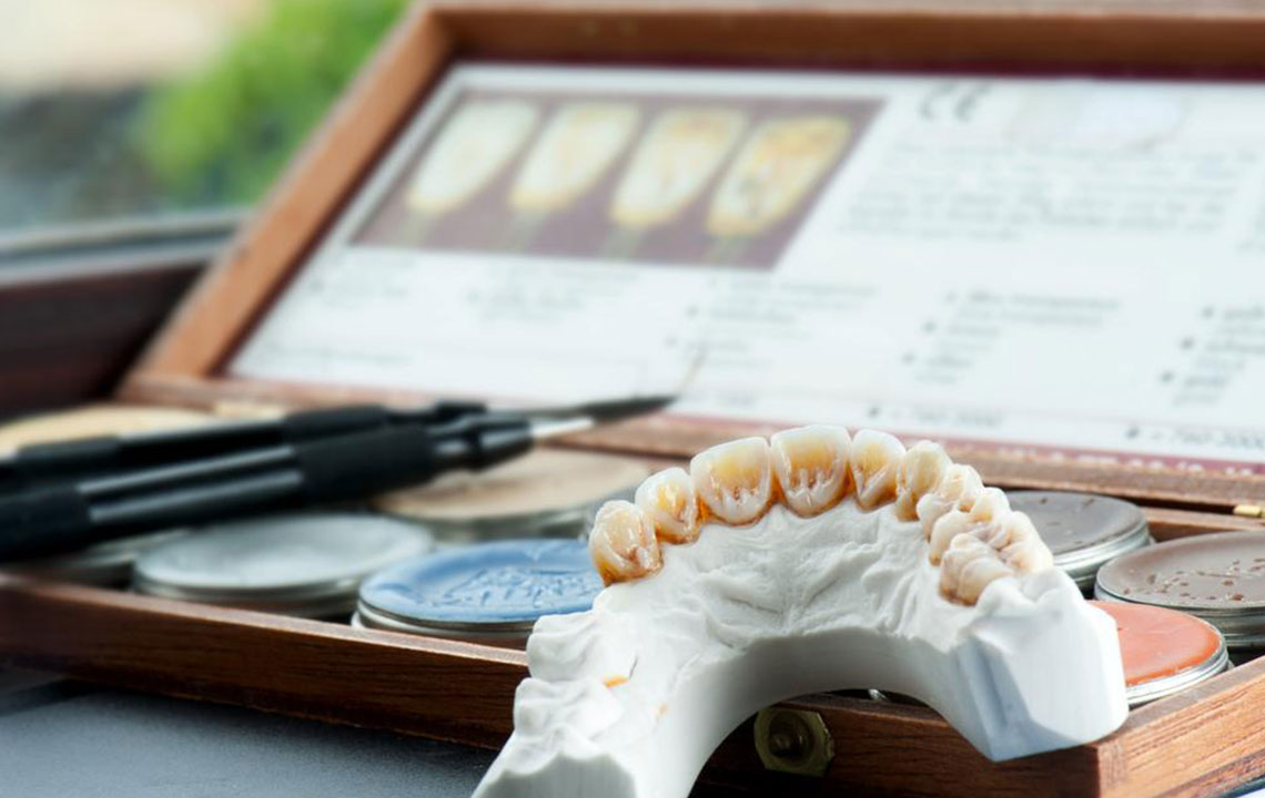 Understanding the Cost and Advantages of Dental Implants