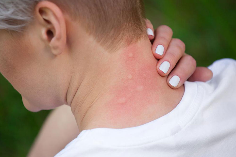 Understanding Itchy Skin: Causes and Diagnostic Methods
