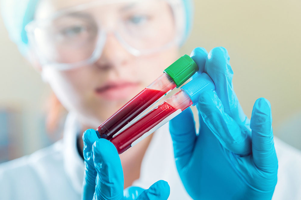 Complete Overview of Hematological Disorders