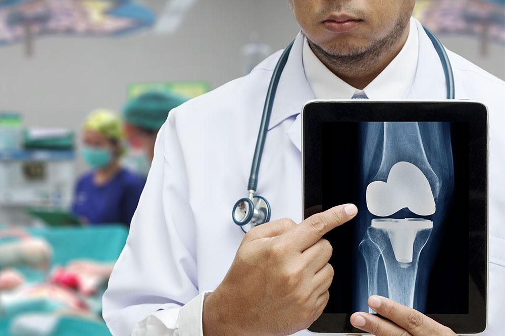 A Comprehensive Guide to Knee Replacement: Understanding & Caring for Your Knees