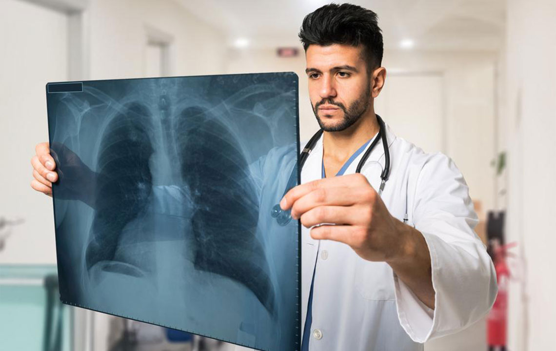 Top 4 Treatment Strategies for Lung Cancer