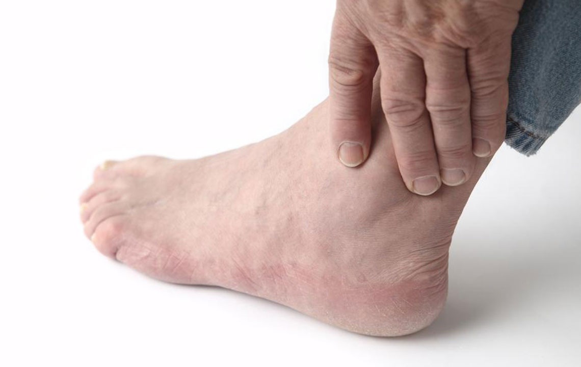 Common Causes of Swollen Ankles and Effective Treatments