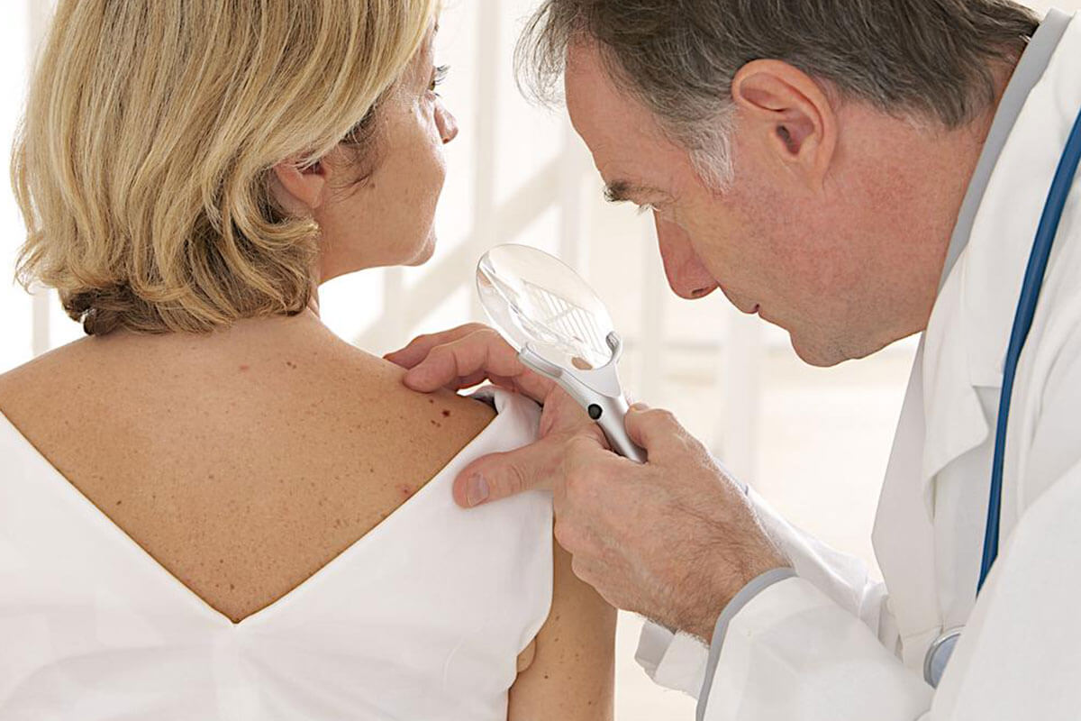 Essential Tips to Prevent Psoriasis Flare-Ups and Stay Skin-Healthy