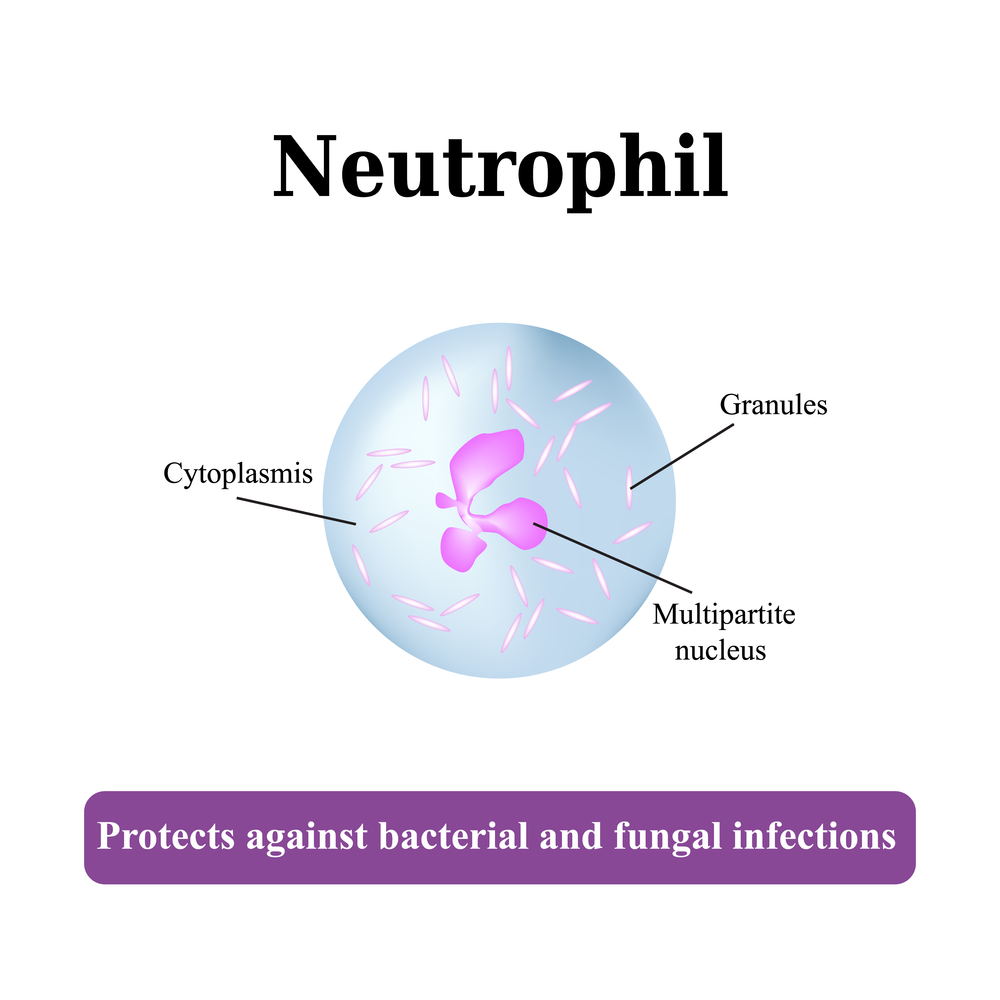 The Critical Importance of Neutrophils in Human Immune Defense Mechanisms
