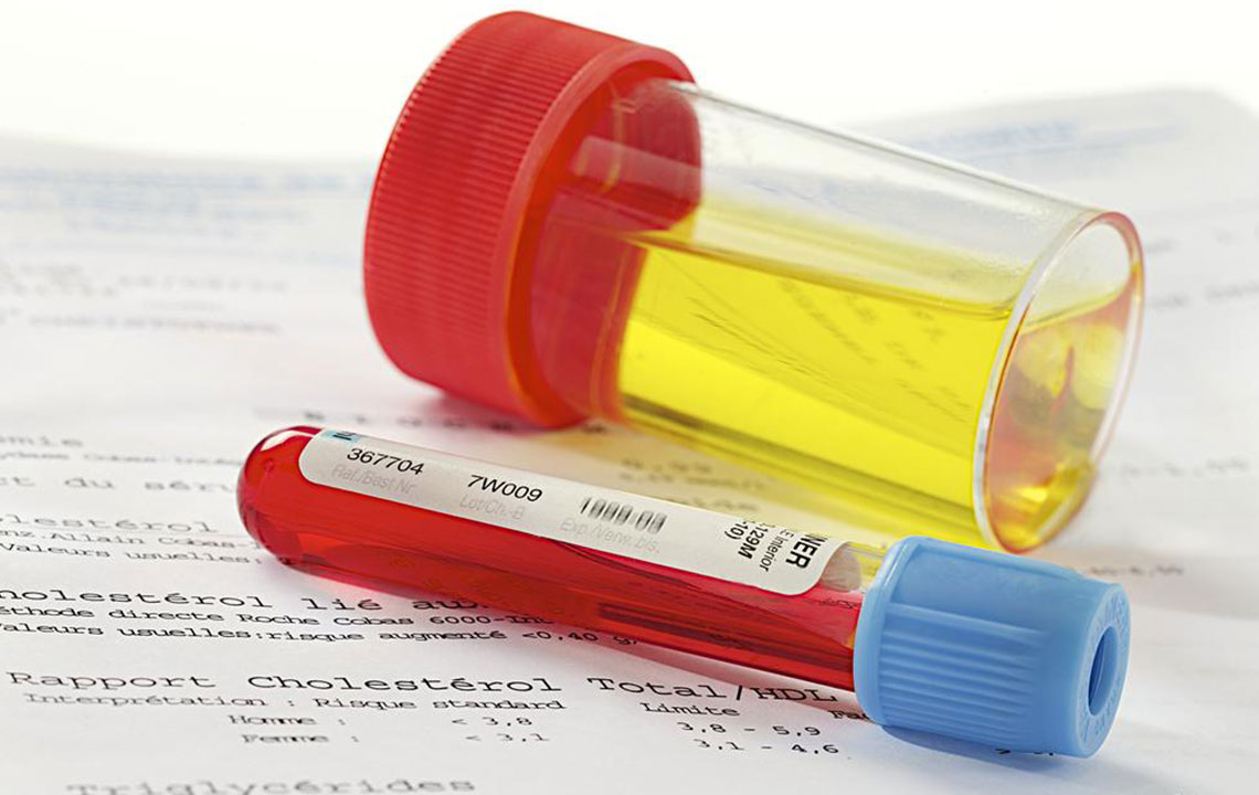 Effective Home Remedies for Urinary Tract Infection Relief