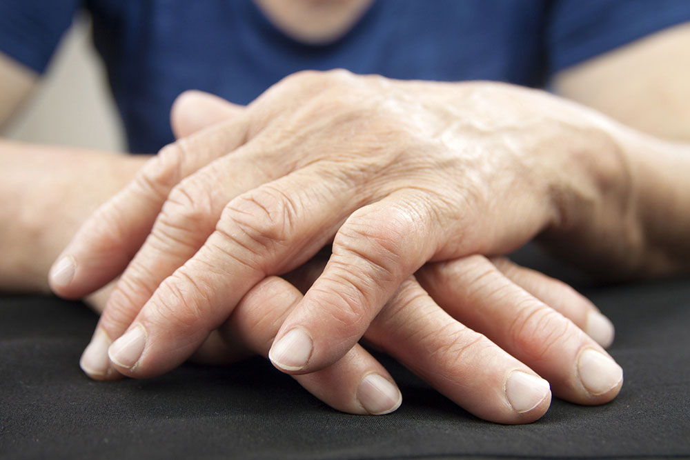Essential Insights into Rheumatoid Arthritis: Causes, Symptoms, and Treatments