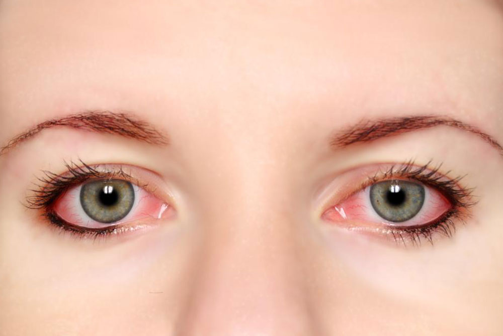 Essential Tips for Proper Contact Lens Maintenance and Safety