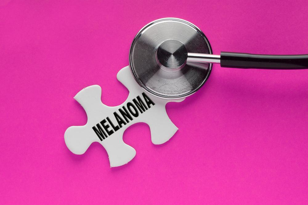 Understanding Melanoma: The Key to Skin Cancer Prevention