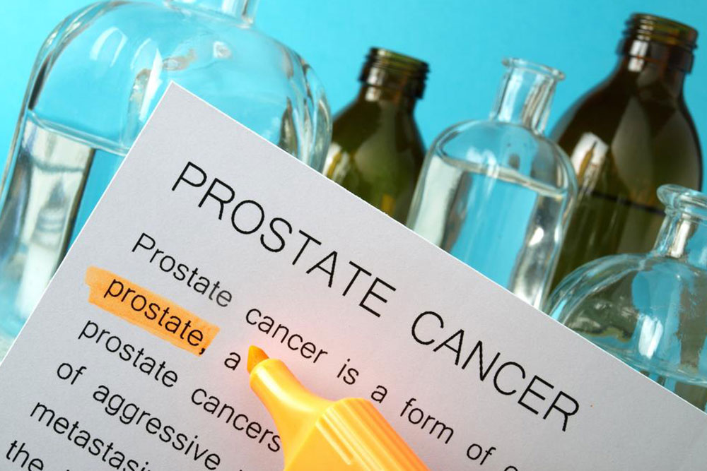 The Role of Genetic Testing in Prostate Cancer Prevention and Management