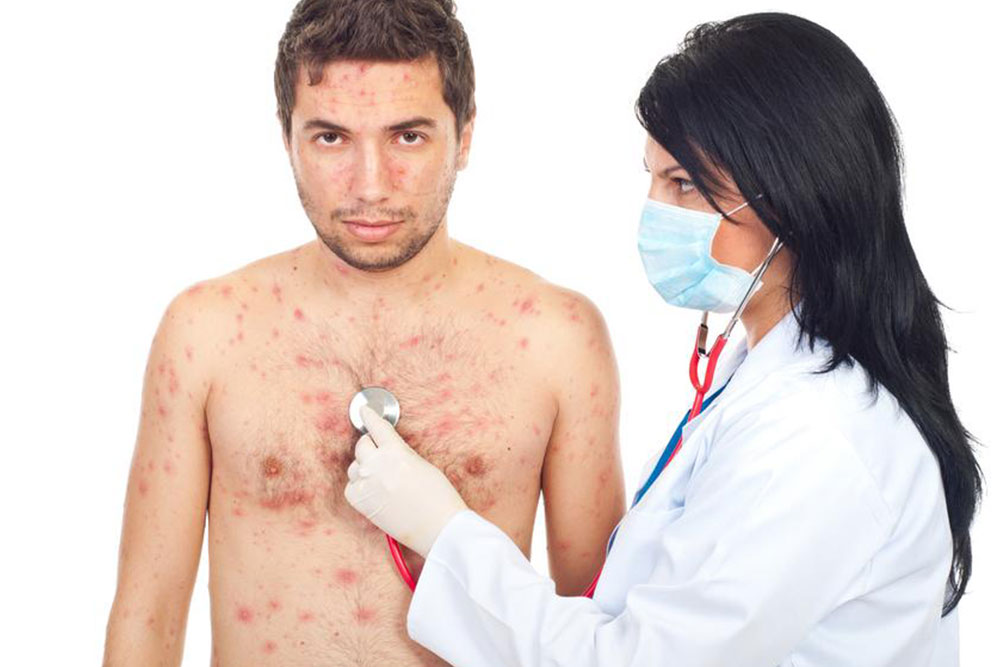 Common Health Risks Linked to Staphylococcus Infections