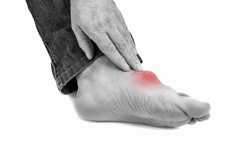 Quick Strategies to Alleviate Gout Discomfort
