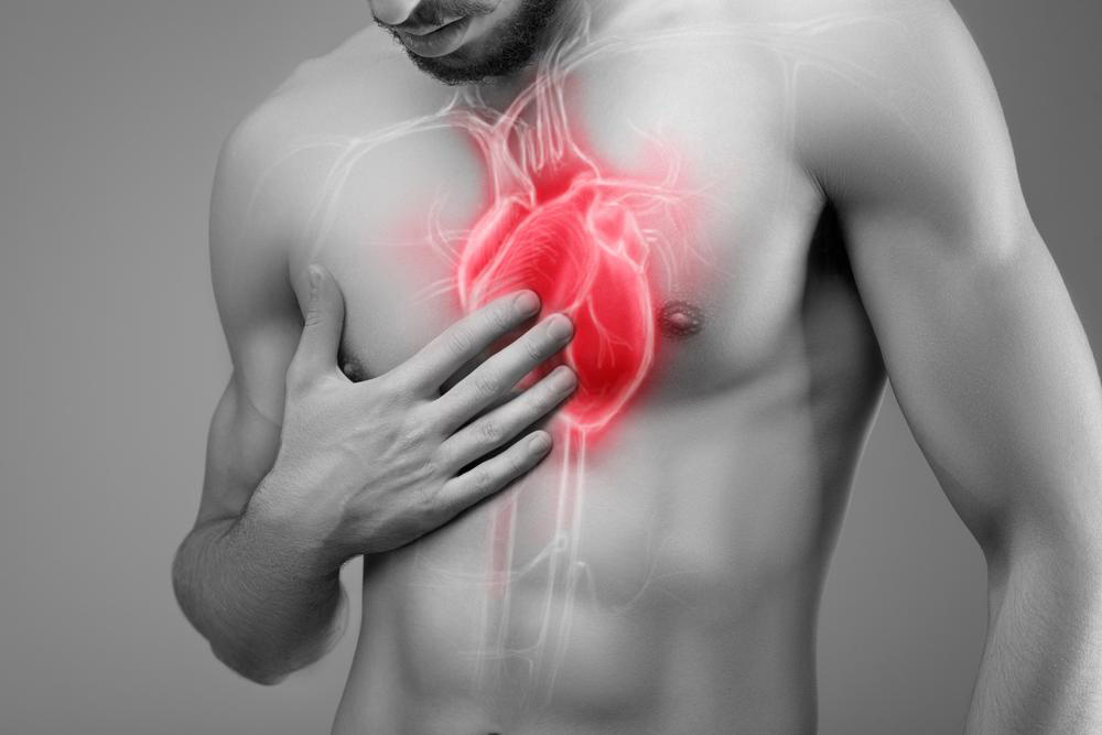 Understanding Atrial Fibrillation: Symptoms and Treatment Options