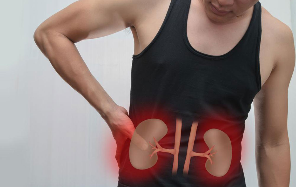 Understanding Kidney Failure: Causes, Symptoms, and Prevention