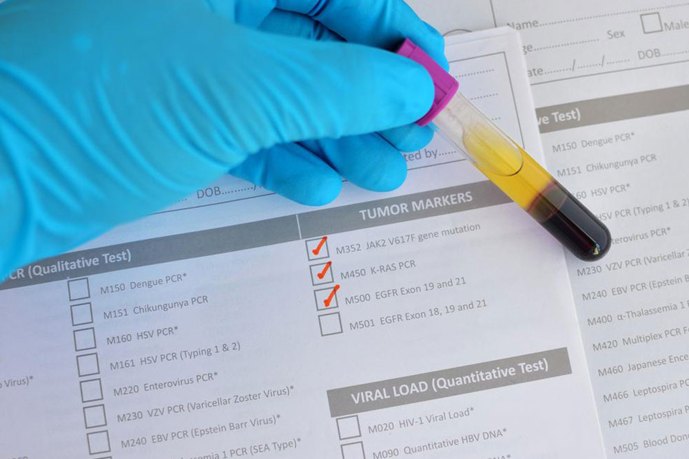 Understanding Liver Diseases and Associated Health Risks