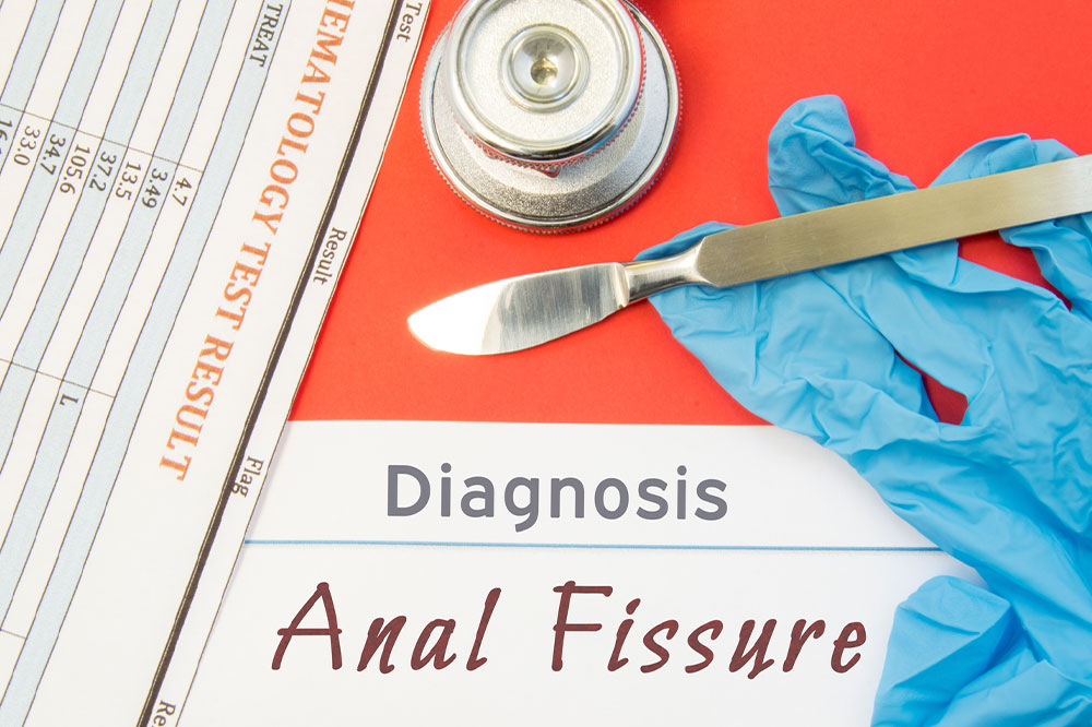 Understanding Anal Fissures: Causes, Symptoms, and Treatment Options