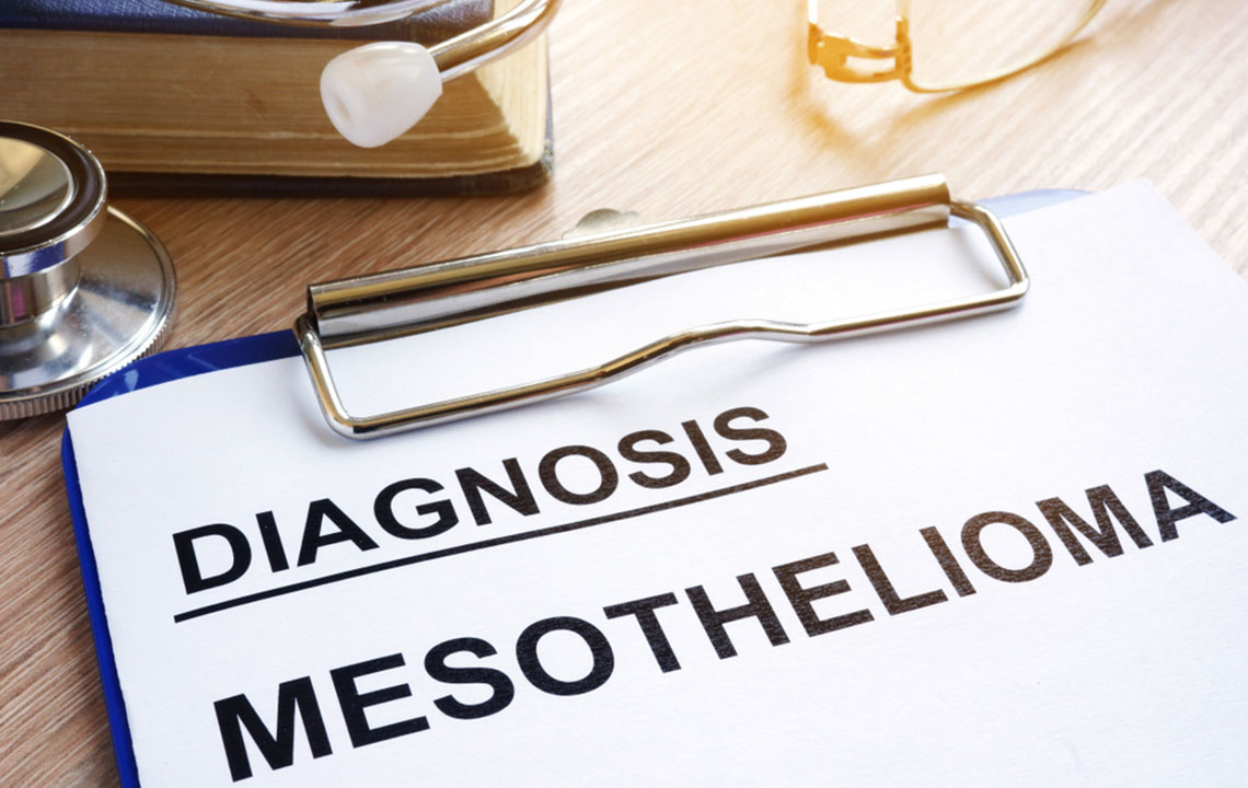 Comprehensive Strategies for Managing Mesothelioma