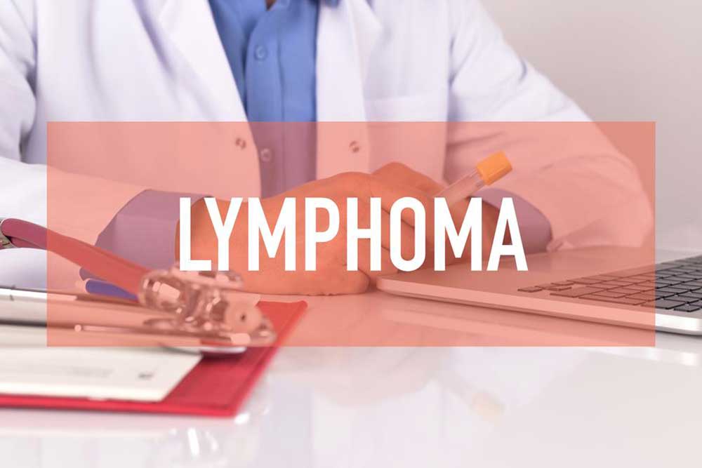 Effective Strategies for Managing Non-Hodgkin Lymphoma Treatments