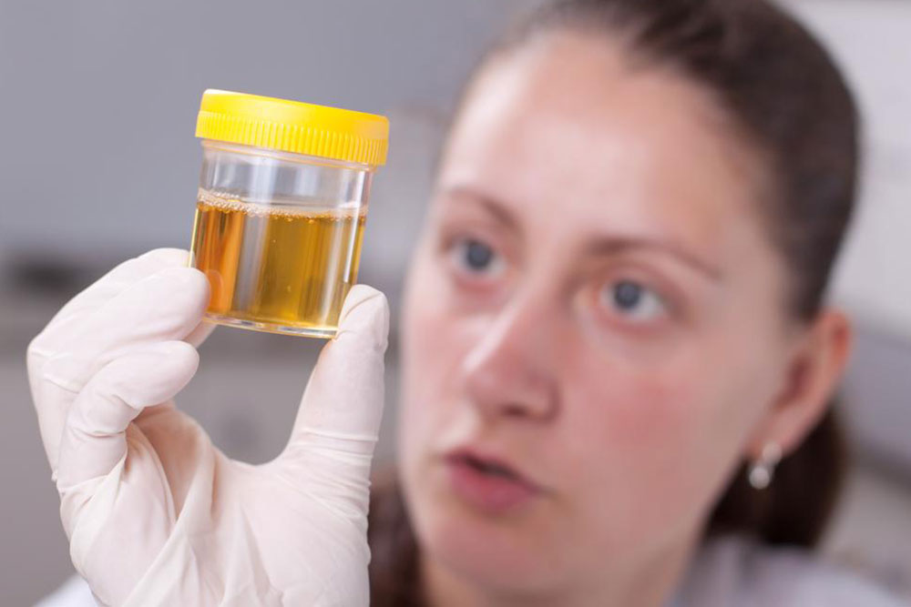 Understanding Urine Colors and Their Health Implications