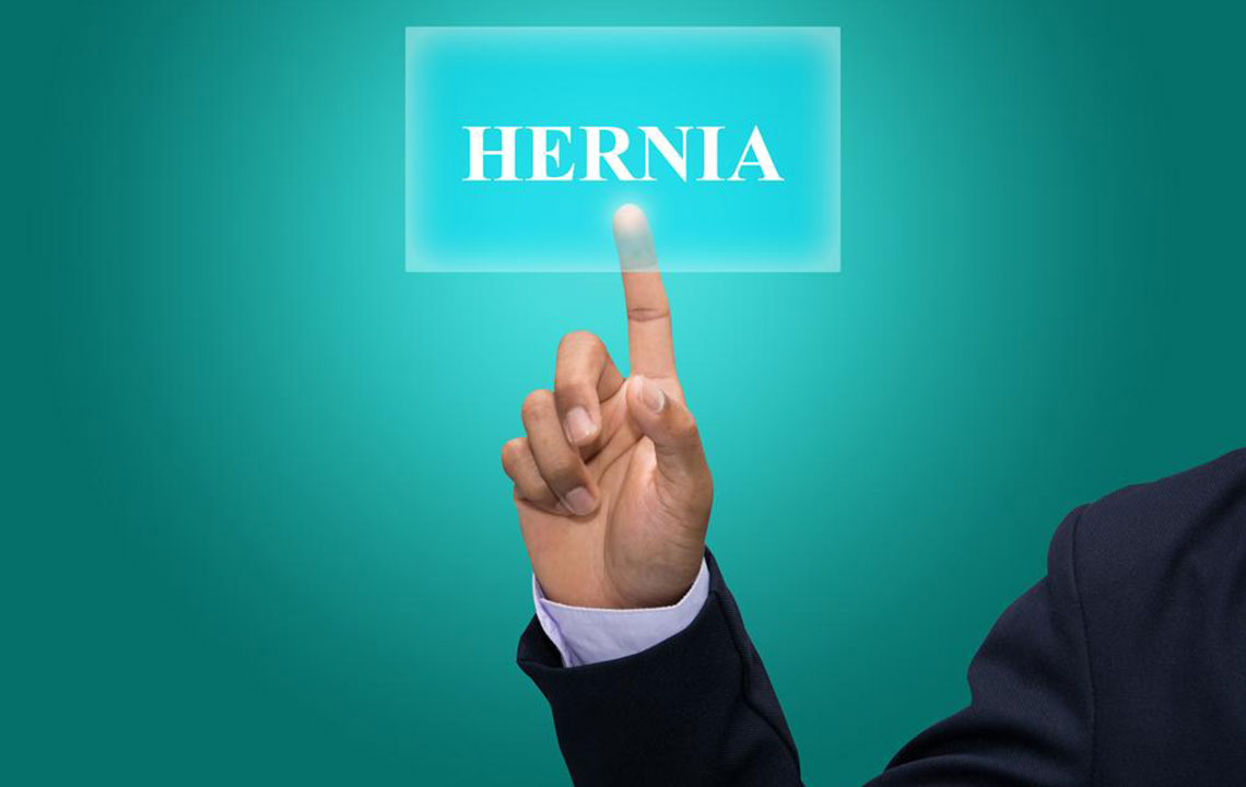 Effective Strategies for Hernia Management and Treatment