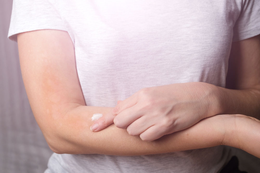 Effective Solutions for Itchy Skin: Top Creams and Natural Remedies