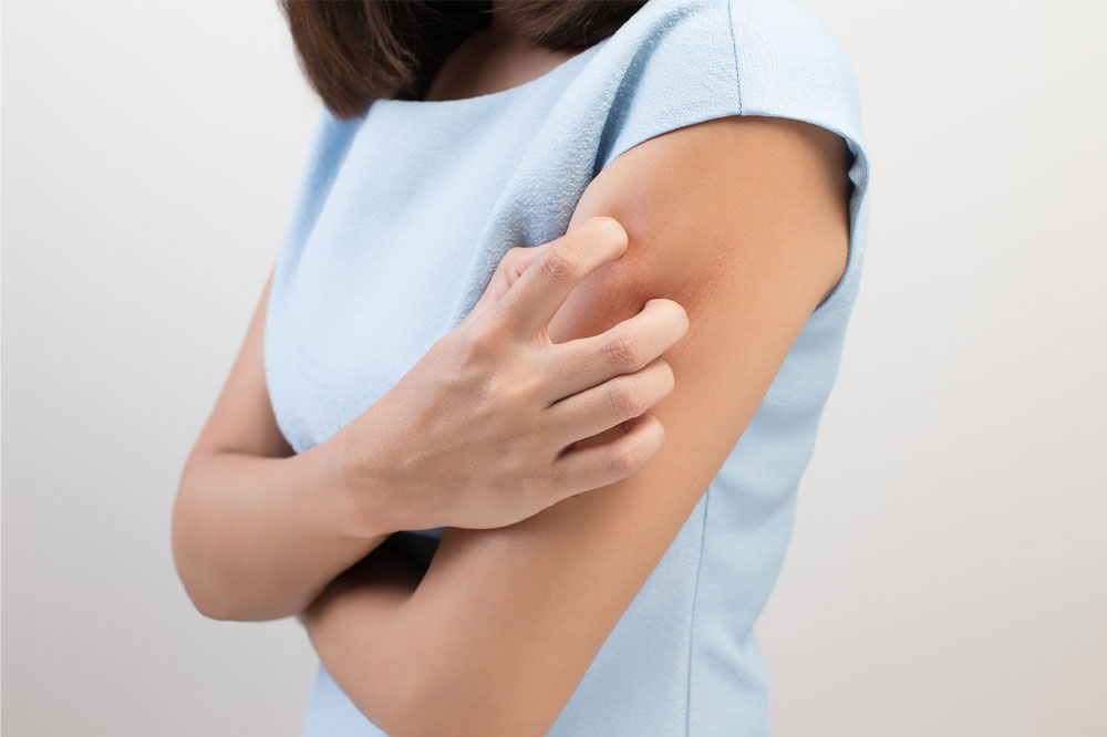 Comprehensive Guide to Common Allergies: Symptoms, Causes, and Prevention Strategies