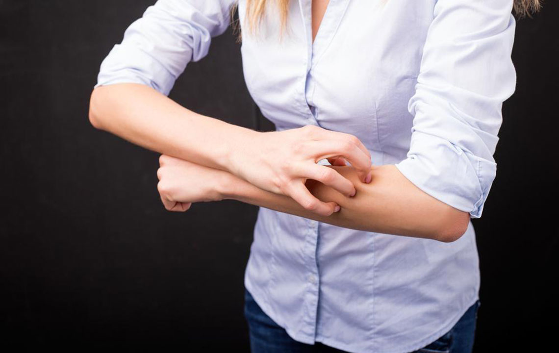 Comprehensive Guide to Effectively Managing Atopic Dermatitis for Long-Term Relief