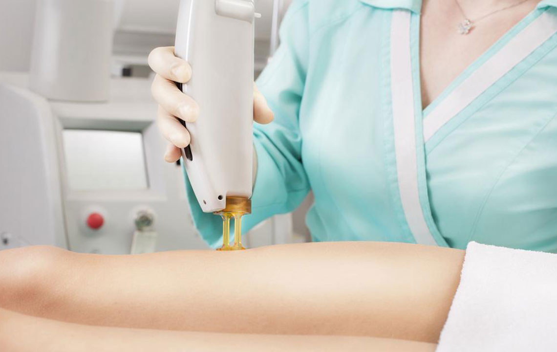 Effective and Budget-Friendly Methods for Removing Body Hair