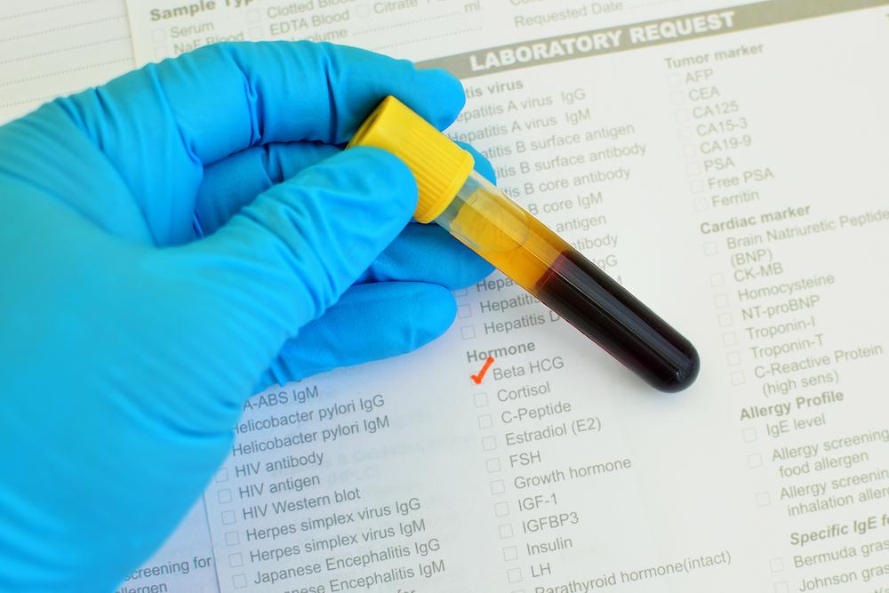 Exploring Various Immunotherapy Approaches to Combat Cancer