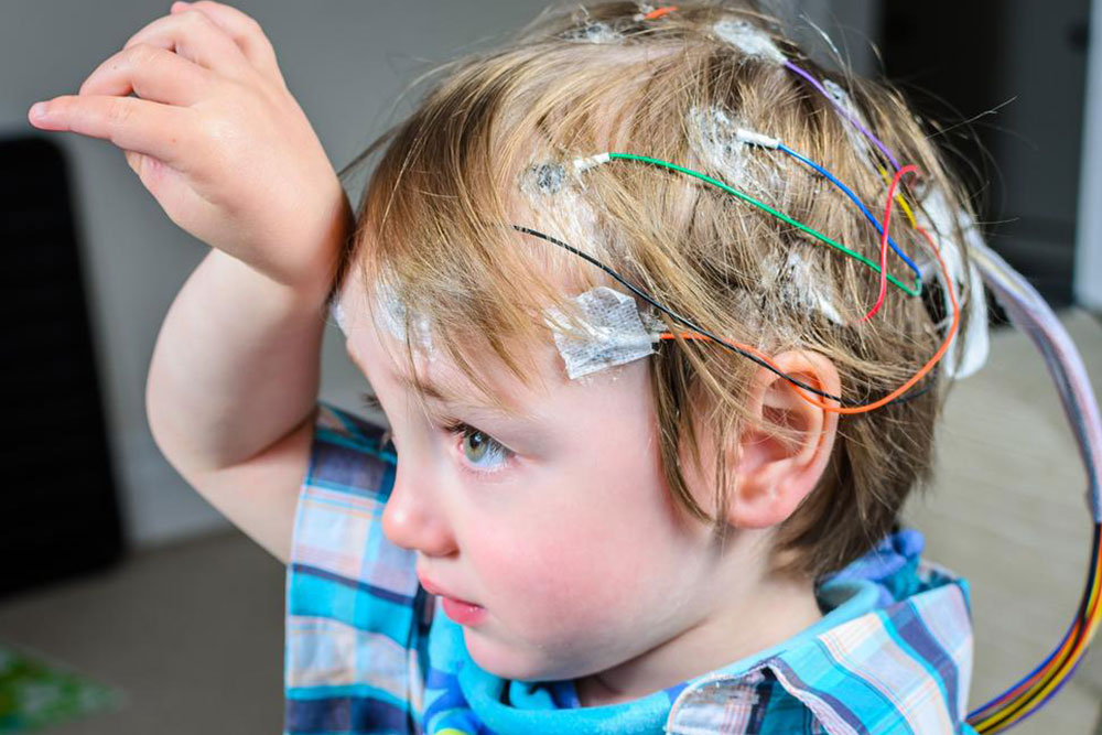 Guide to Helping Someone During an Epileptic Seizure
