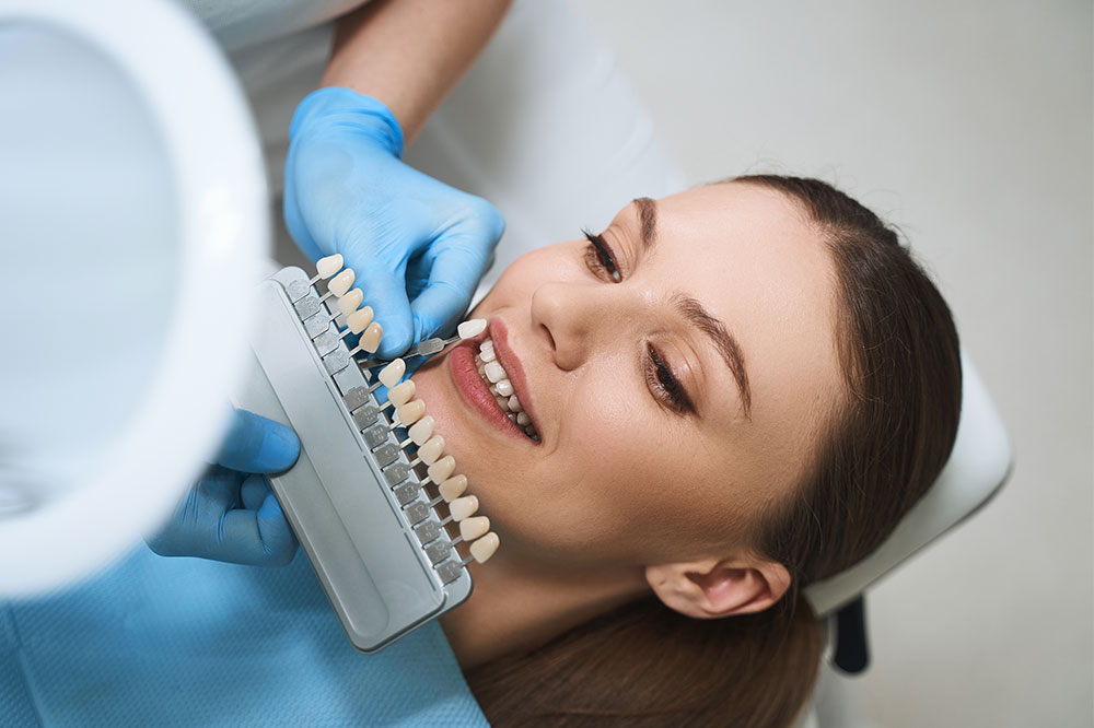 Essential Insights Before Choosing Dental Veneers