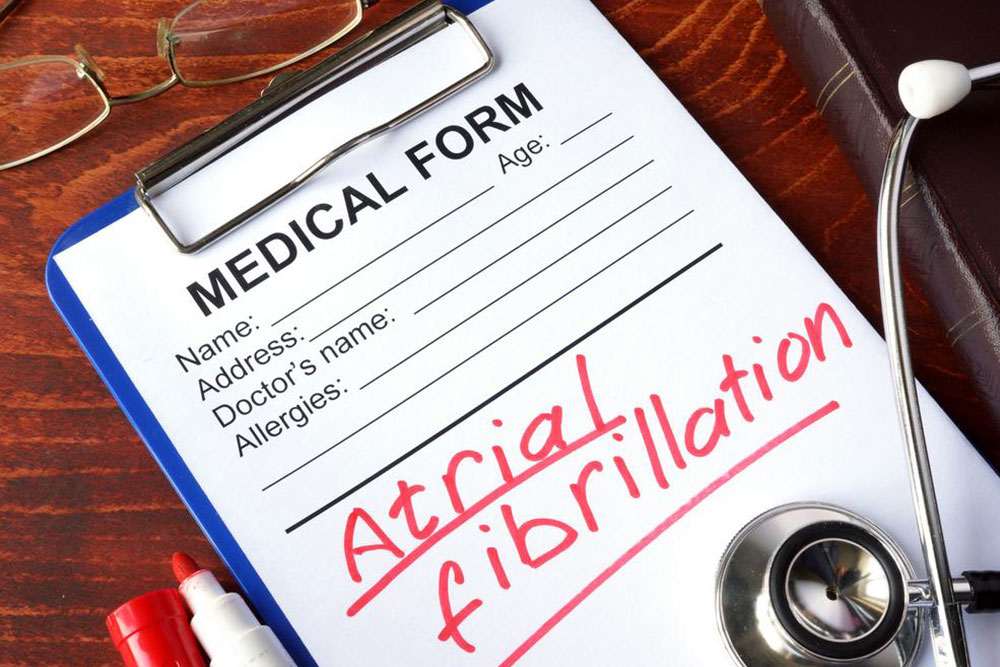 Comprehensive Guide to Managing Atrial Fibrillation