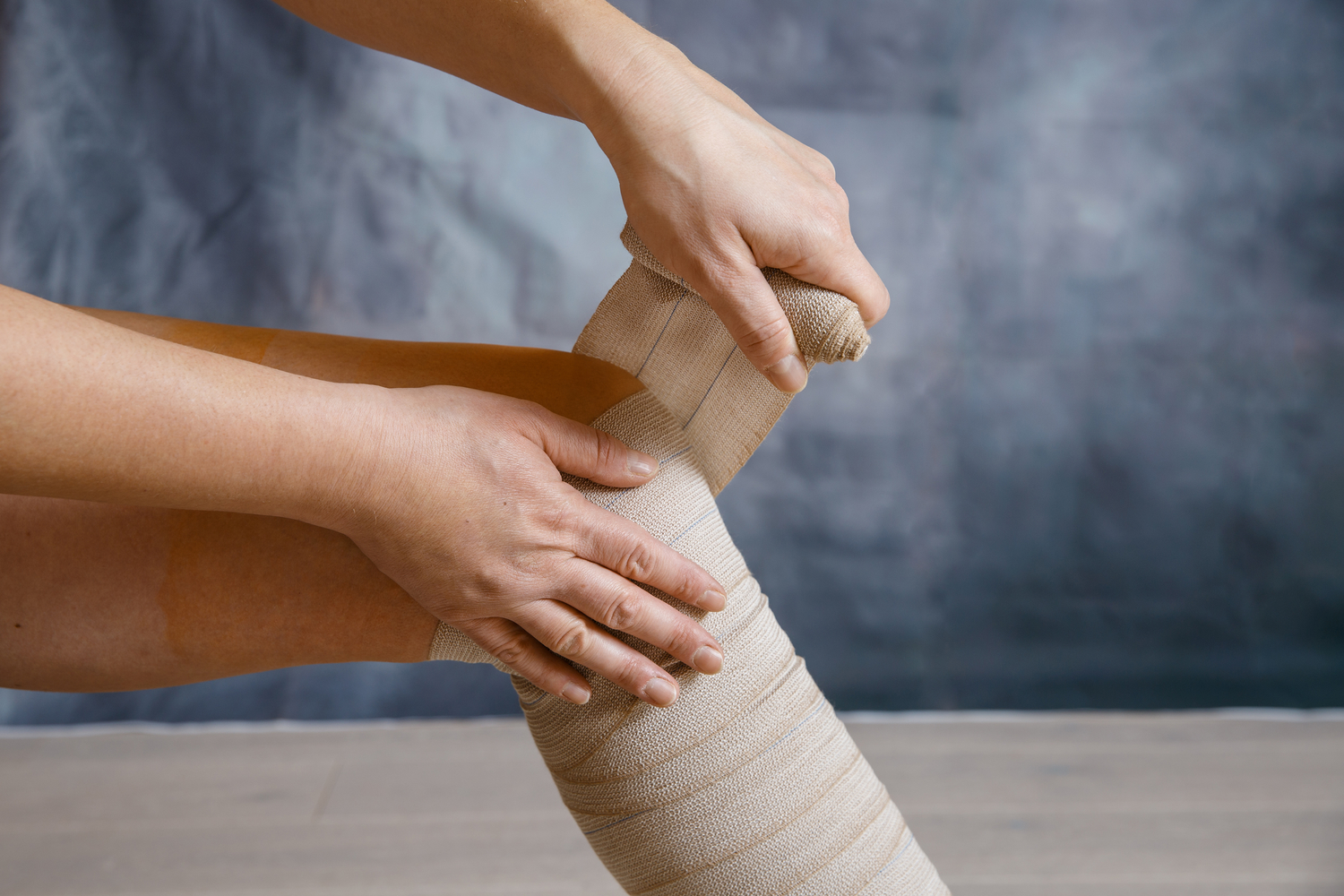 Comprehensive Guide to Catheter-Directed Thrombolysis for Effective Venous Clot Removal
