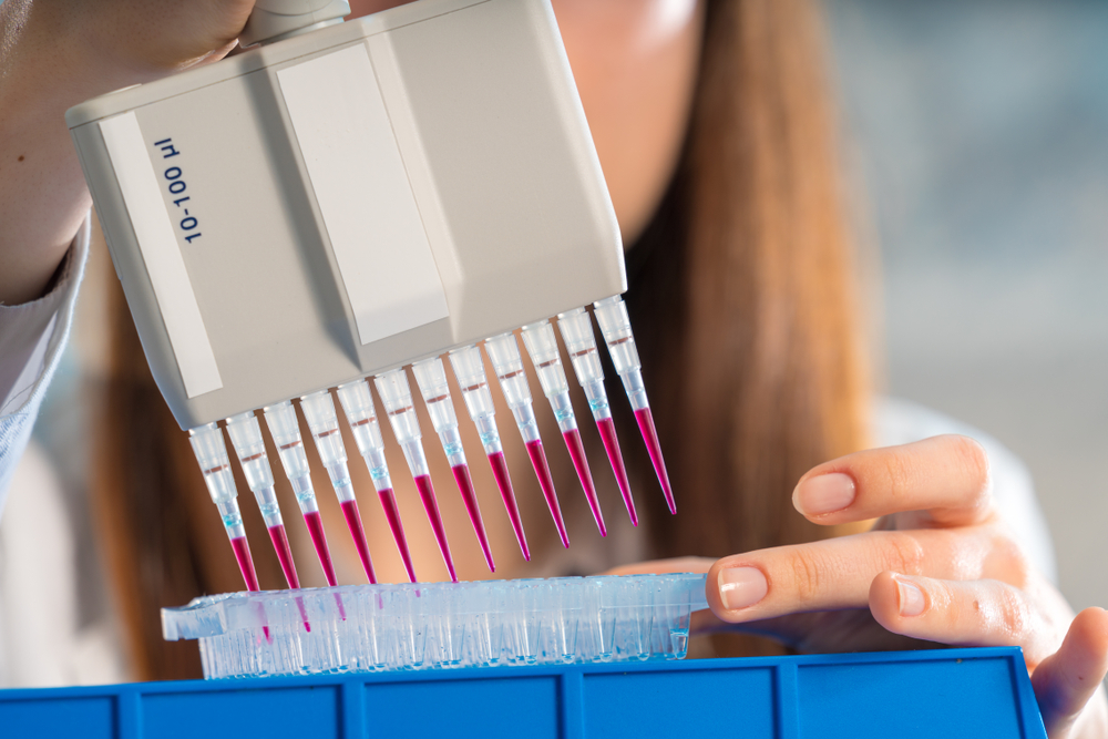Choosing the Perfect DNA Testing Kit: A Comprehensive Guide to Unlock Your Ancestry and Health Insights