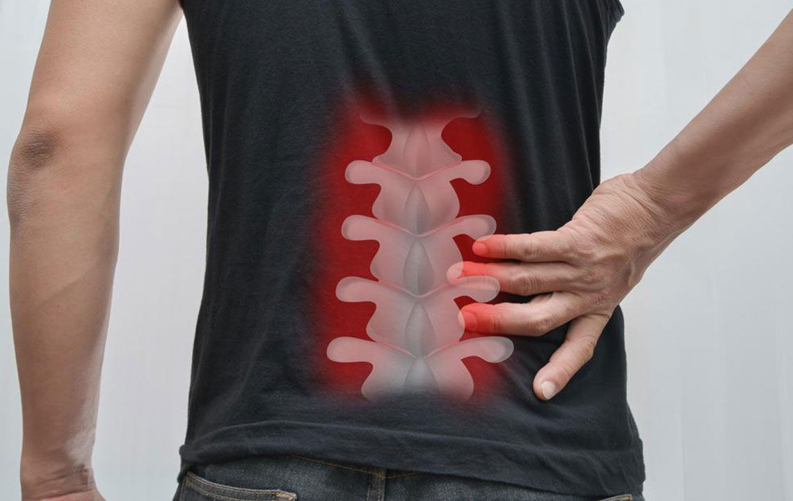 Comprehensive Guide to Spinal Fusion Surgery