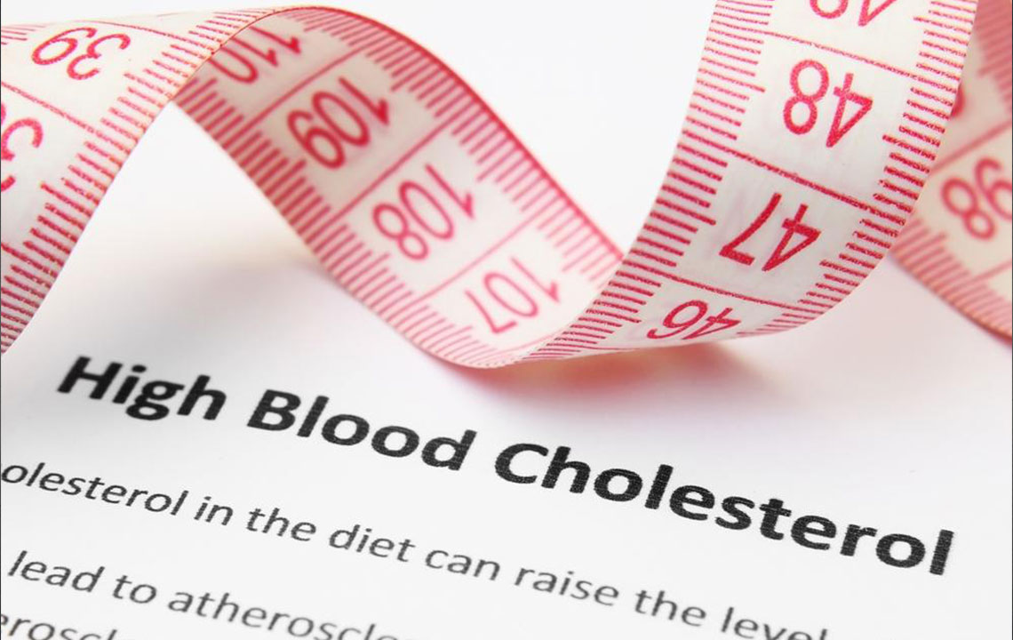 Simple Guide to Assessing Cholesterol Levels