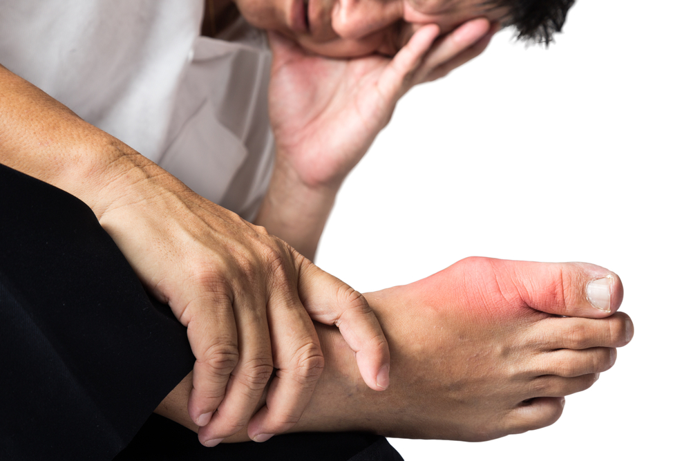 Understanding Common Causes and Risks of Gout
