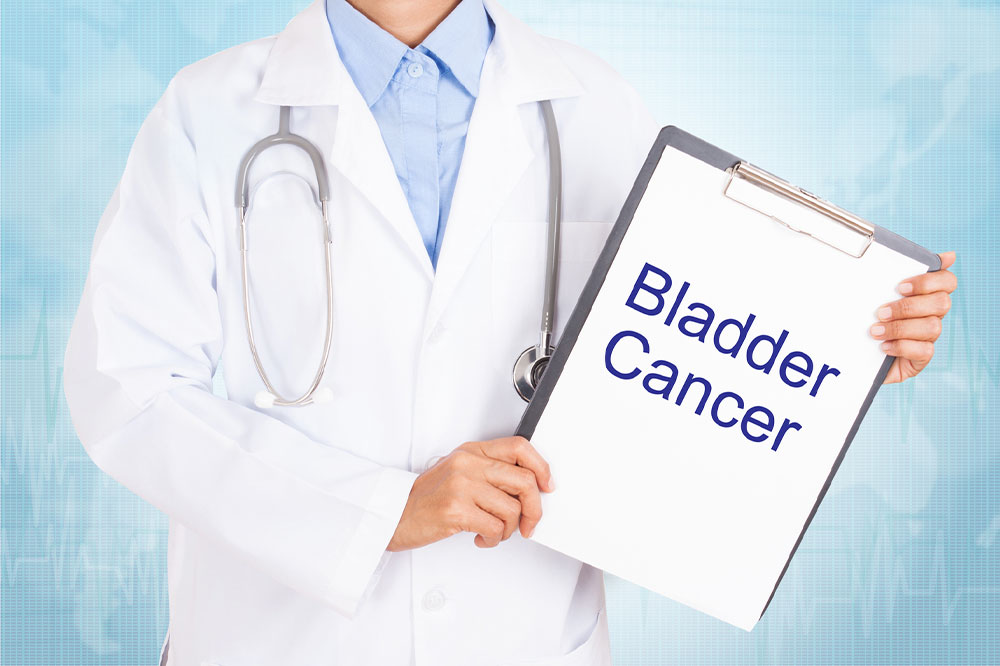 Comprehensive Guide to Bladder Cancer Diagnosis and Treatment Strategies