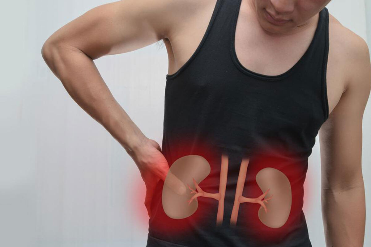 Essential Kidney Cancer Symptoms You Should Not Ignore