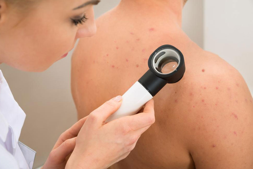 Debunking Common Misconceptions About Fungal Skin Infections