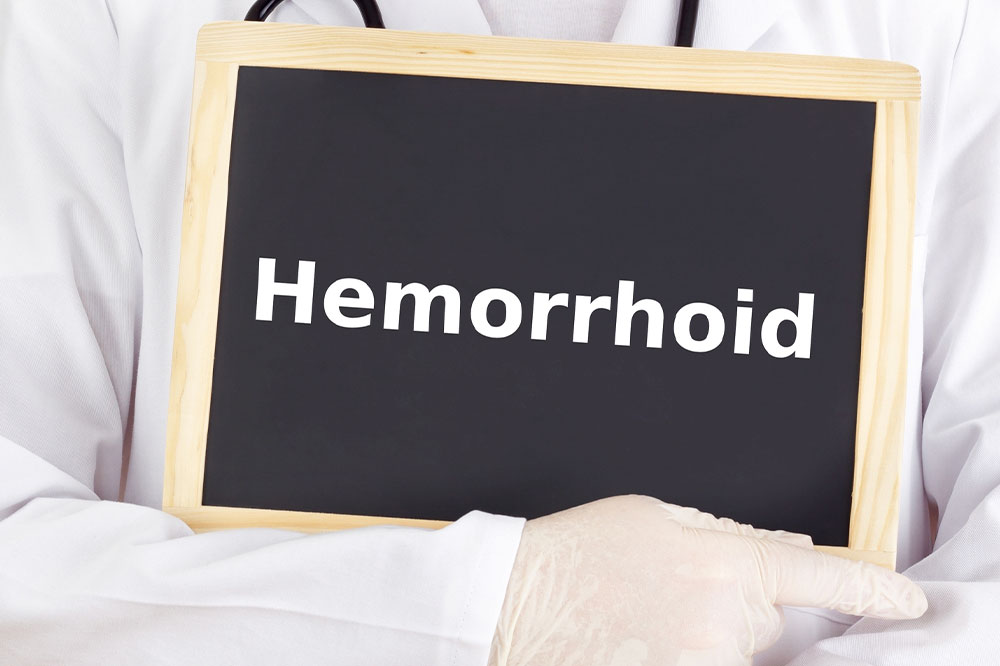 Understanding Hemorrhoids: Causes, Symptoms, and Treatment Options