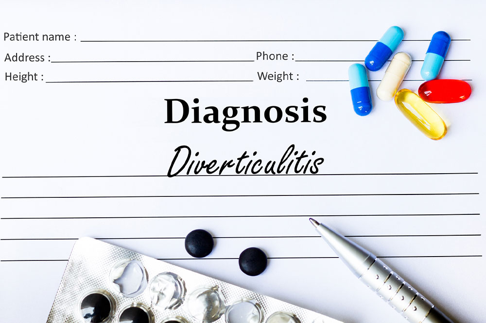 Understanding Diverticulitis: Causes, Symptoms, and Management Strategies