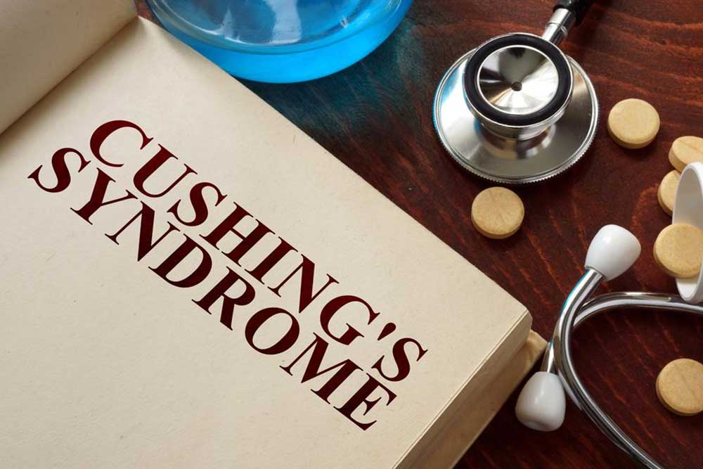 Recognizing the Key Indicators of Cushing Syndrome
