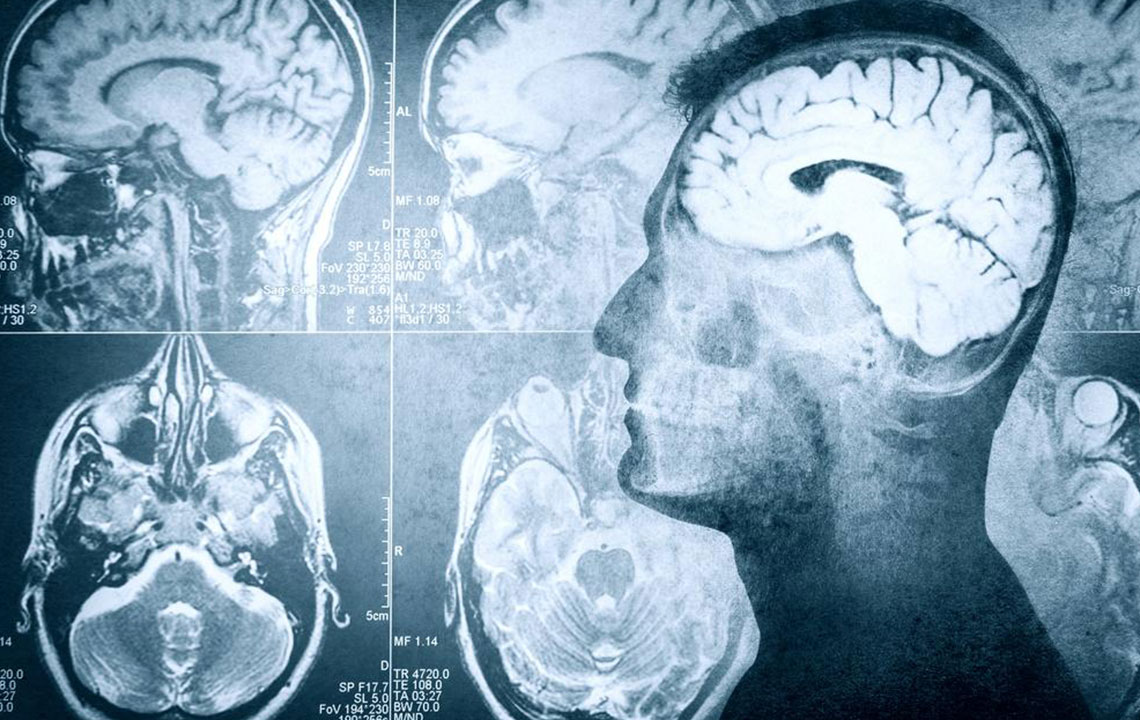 Comprehensive Approaches to Managing Seizures