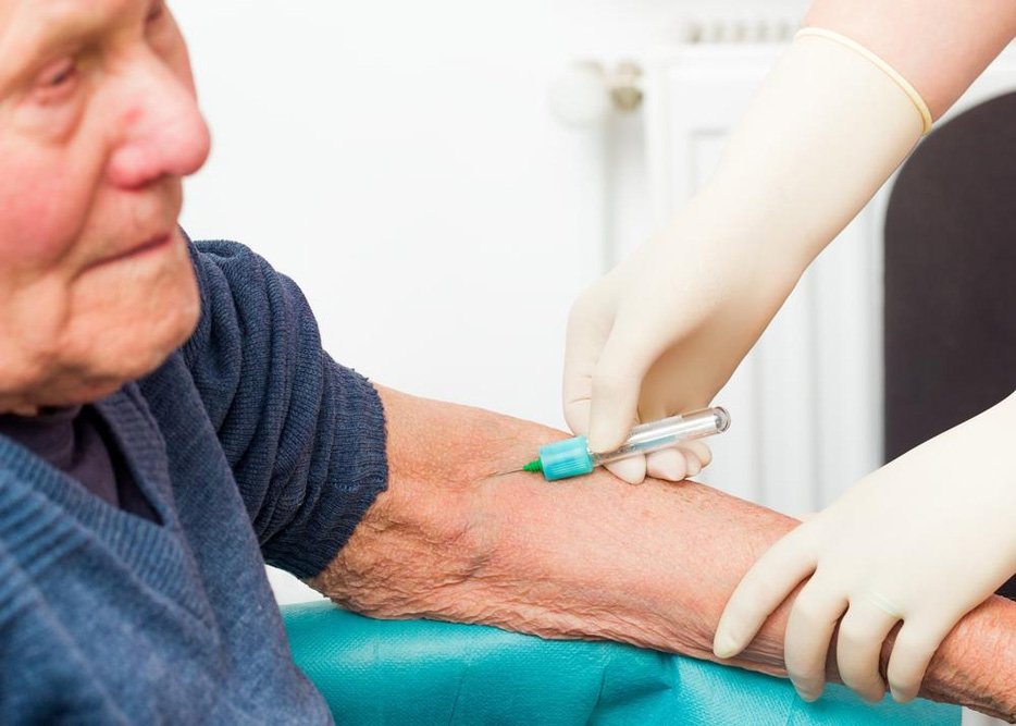 Essential Safety Guidelines While Using Anticoagulant Medications