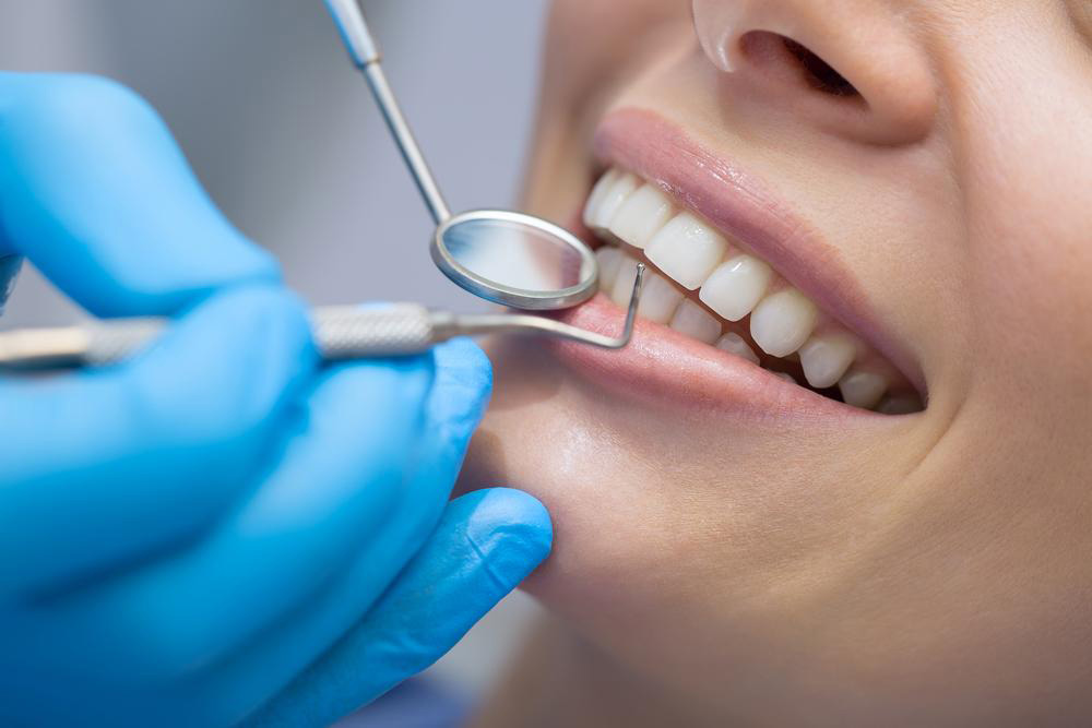 Guide to Dental Implant Expectations and Care