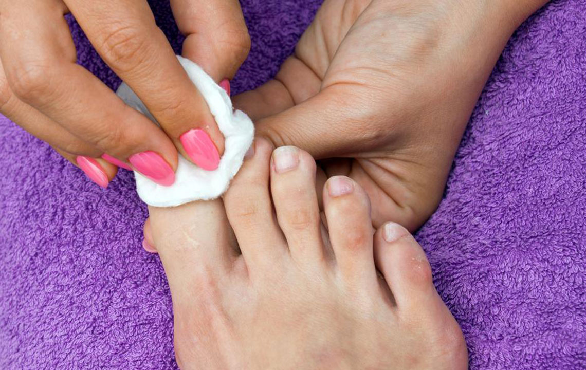 Proven Strategies to Eliminate Fingernail Fungal Infections