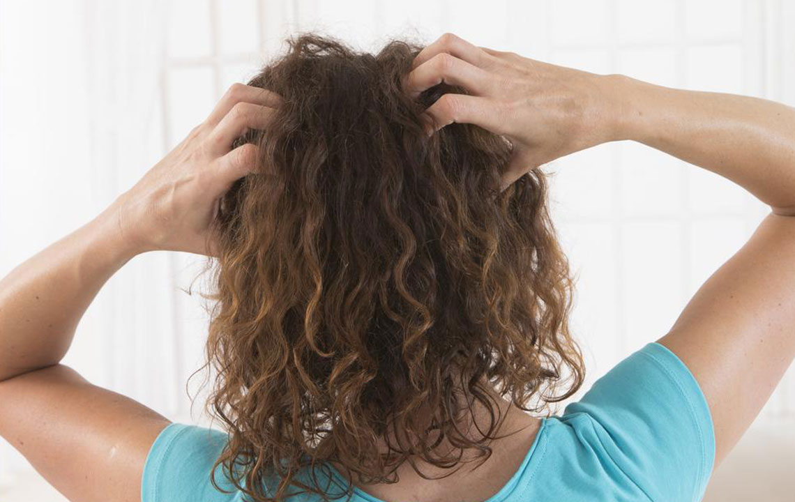 Comprehensive Guide to Recognizing and Managing Scalp Psoriasis Effectively
