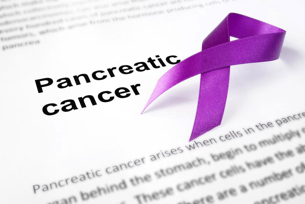 Essential Insights on Managing Advanced Stage 4 Pancreatic Cancer